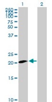 Anti-CLDN20 antibody produced in mouse purified immunoglobulin, buffered aqueous solution