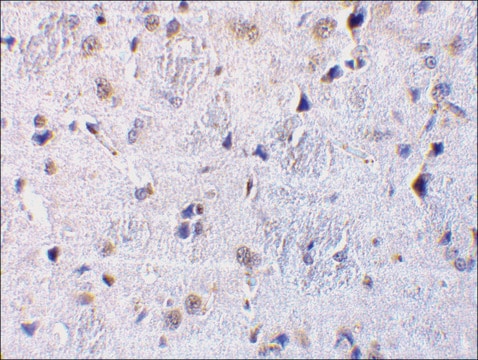 Anti-CTRP7 (ab2) antibody produced in rabbit affinity isolated antibody, buffered aqueous solution