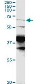 Anti-CPEB1 antibody produced in rabbit purified immunoglobulin, buffered aqueous solution