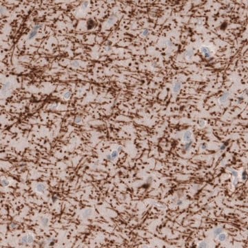 Monoclonal Anti-MBP antibody produced in mouse Prestige Antibodies&#174; Powered by Atlas Antibodies, clone CL2827, purified immunoglobulin, buffered aqueous glycerol solution