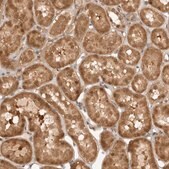 Anti-DCAF8 antibody produced in rabbit Prestige Antibodies&#174; Powered by Atlas Antibodies, affinity isolated antibody, buffered aqueous glycerol solution