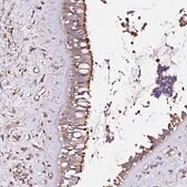 Anti-KLHL11 antibody produced in rabbit Prestige Antibodies&#174; Powered by Atlas Antibodies, affinity isolated antibody, buffered aqueous glycerol solution