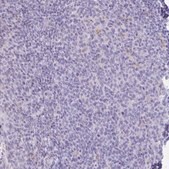 Anti-XCL1 antibody produced in rabbit Prestige Antibodies&#174; Powered by Atlas Antibodies, affinity isolated antibody, buffered aqueous glycerol solution