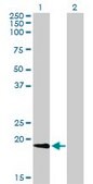 Monoclonal Anti-NME1 antibody produced in mouse clone 2H1, purified immunoglobulin, buffered aqueous solution