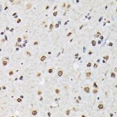 Anti-Matrin 3 antibody produced in rabbit