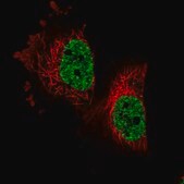 Anti-PARPBP antibody produced in rabbit Prestige Antibodies® Powered by Atlas Antibodies, affinity isolated antibody, buffered aqueous glycerol solution