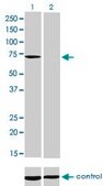 Monoclonal Anti-MTM1 antibody produced in mouse clone 1C10, purified immunoglobulin, buffered aqueous solution