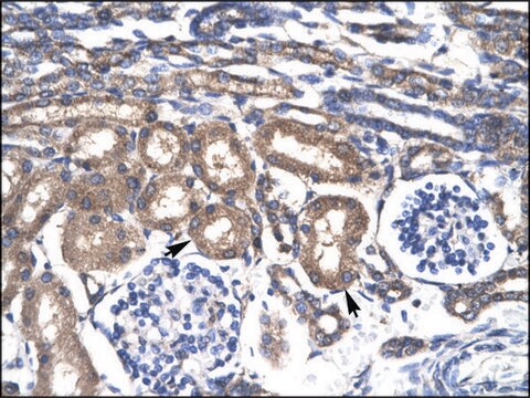Anti-KLF8 affinity isolated antibody