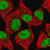 Anti-SPANXC antibody produced in rabbit Prestige Antibodies&#174; Powered by Atlas Antibodies, affinity isolated antibody, buffered aqueous glycerol solution