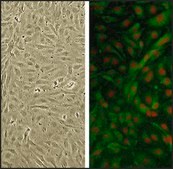Human Brachiocephalic Artery Endothelial Cells: HBcAEC, adult