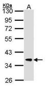 Anti-FBXL12 (C-terminal) antibody produced in rabbit affinity isolated antibody, buffered aqueous solution