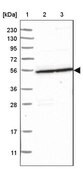 Anti-S100PBP antibody produced in rabbit Prestige Antibodies&#174; Powered by Atlas Antibodies, affinity isolated antibody, buffered aqueous glycerol solution