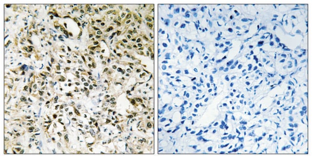 Anti-PPHLN antibody produced in rabbit affinity isolated antibody