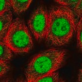 Anti-ZIC4 antibody produced in rabbit Prestige Antibodies&#174; Powered by Atlas Antibodies, affinity isolated antibody, buffered aqueous glycerol solution
