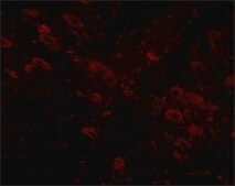 Anti-GLE1 (ab1) antibody produced in rabbit affinity isolated antibody, buffered aqueous solution