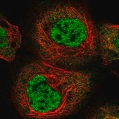 Anti-RBM15B antibody produced in rabbit Prestige Antibodies&#174; Powered by Atlas Antibodies, affinity isolated antibody, buffered aqueous glycerol solution