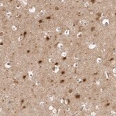 Anti-PTK2B antibody produced in rabbit Prestige Antibodies&#174; Powered by Atlas Antibodies, affinity isolated antibody, buffered aqueous glycerol solution, ab1