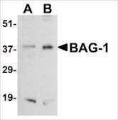 Anti-BAG-1 antibody produced in rabbit affinity isolated antibody, buffered aqueous solution