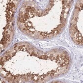Anti-LZTFL1 antibody produced in rabbit Prestige Antibodies&#174; Powered by Atlas Antibodies, affinity isolated antibody, buffered aqueous glycerol solution