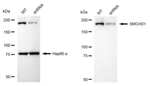 KD-Validated Anti SMCHD1 Antibody, clone 24GB2385, Rabbit Monoclonal clone 24GB2385, recombinant rabbit monoclonal, expressed in HEK293 cells