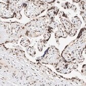 Anti-NRF1 antibody produced in rabbit Prestige Antibodies&#174; Powered by Atlas Antibodies, affinity isolated antibody, buffered aqueous glycerol solution