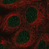 Anti-GLB1L2 antibody produced in rabbit Prestige Antibodies&#174; Powered by Atlas Antibodies, affinity isolated antibody, buffered aqueous glycerol solution