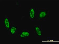 Monoclonal Anti-ALPK3 antibody produced in mouse clone 4G4, purified immunoglobulin, buffered aqueous solution
