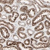 Anti-TMEM176A antibody produced in rabbit Prestige Antibodies® Powered by Atlas Antibodies, affinity isolated antibody, buffered aqueous glycerol solution