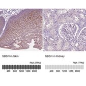 Anti-SBSN antibody produced in rabbit Prestige Antibodies® Powered by Atlas Antibodies, affinity isolated antibody, buffered aqueous glycerol solution