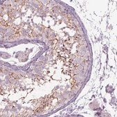 Anti-SEPT14 antibody produced in rabbit Prestige Antibodies&#174; Powered by Atlas Antibodies, affinity isolated antibody