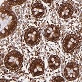 Anti-FARSA antibody produced in rabbit Prestige Antibodies&#174; Powered by Atlas Antibodies, affinity isolated antibody, buffered aqueous glycerol solution