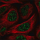 Anti-KDM6B antibody produced in rabbit Prestige Antibodies® Powered by Atlas Antibodies, affinity isolated antibody, buffered aqueous glycerol solution