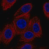 Monoclonal Anti-GJB6 antibody produced in mouse Prestige Antibodies® Powered by Atlas Antibodies, clone CL4540, purified immunoglobulin, buffered aqueous glycerol solution