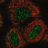 Anti-ZNF76 antibody produced in rabbit Prestige Antibodies&#174; Powered by Atlas Antibodies, affinity isolated antibody, buffered aqueous glycerol solution