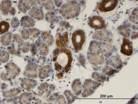 Monoclonal Anti-MVK, (C-terminal) antibody produced in mouse clone 2C5, purified immunoglobulin, buffered aqueous solution