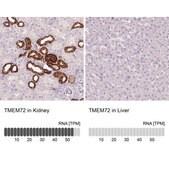Anti-TMEM72 antibody produced in rabbit Prestige Antibodies® Powered by Atlas Antibodies, affinity isolated antibody, buffered aqueous glycerol solution