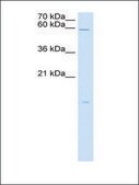 Anti-RARRES3 antibody produced in rabbit IgG fraction of antiserum