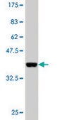 Monoclonal Anti-CAND1 antibody produced in mouse clone 1G5, purified immunoglobulin, buffered aqueous solution