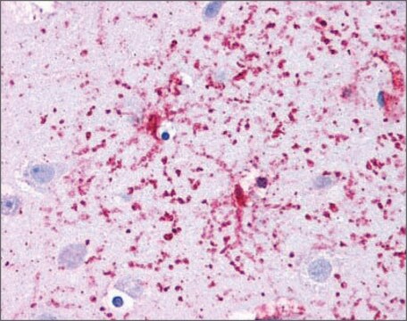 Anti-GLUD1 affinity isolated antibody