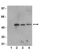 MAPK Pathway 1 Explorer Antibody MiniPack clone AW39R, 1&#160;mg/mL (05-538SP), Upstate&#174;