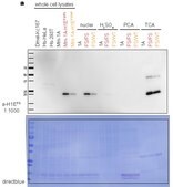 Anti-Histone H1E frameshift mutant