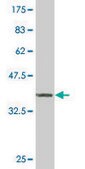 ANTI-ZIC3 antibody produced in mouse clone 2G1, purified immunoglobulin, buffered aqueous solution