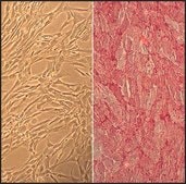 Human Brachiocephalic Artery Smooth Muscle Cells: HBcASMC, adult