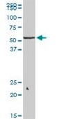 Monoclonal Anti-KLF10 antibody produced in mouse clone 2E7, purified immunoglobulin, buffered aqueous solution