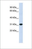 Anti-HOXC8 antibody produced in rabbit affinity isolated antibody