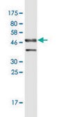 Monoclonal Anti-DMRTB1 antibody produced in mouse clone 5E7, purified immunoglobulin, buffered aqueous solution
