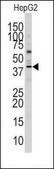 Anti-TASP1 N-term antibody produced in rabbit IgG fraction of antiserum, buffered aqueous solution