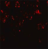 Anti-CHD7 antibody produced in rabbit affinity isolated antibody