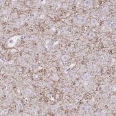 Anti-CREG2 antibody produced in rabbit Prestige Antibodies&#174; Powered by Atlas Antibodies, affinity isolated antibody, buffered aqueous glycerol solution