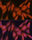 Anti-Laminin beta 1 Antibody, clone 6I9T4, Rabbit Monoclonal